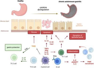 Pro- and anti-inflammatory cytokines: the hidden keys to autoimmune gastritis therapy